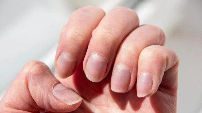 630e2124b57f1508fcb8a922