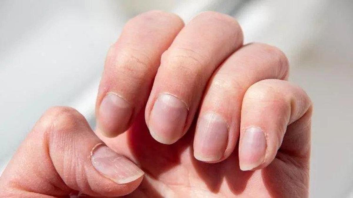 630e2124b57f1508fcb8a922