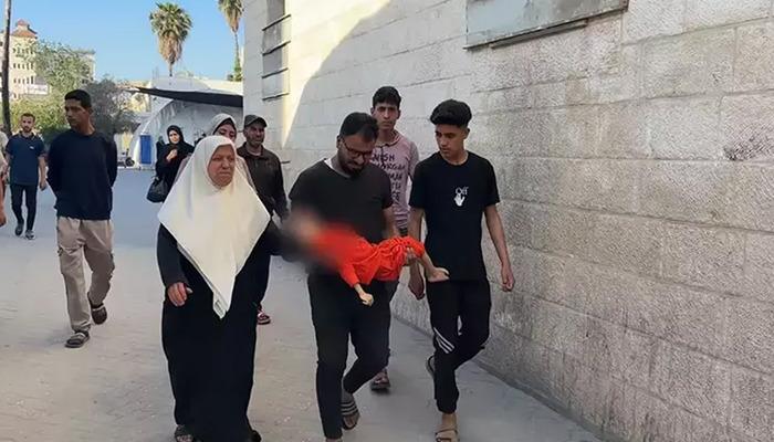 İsrail'in ablukası sonucu Gazze'de 4 yaşındaki bir çocuk açlıktan öldü 1 20203592