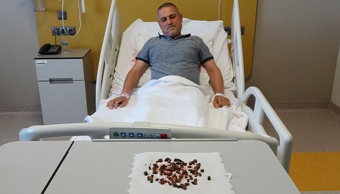 Doktorları şaşkına çeviren vaka: Adamın böbreğinden 100'e yakın taş çıktı: "Sağ böbreğin tamamı taşla doluydu" 1 20917853