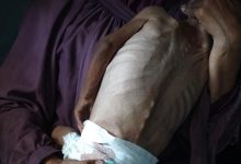 Gazzede son 24 saatte 5 Filistinli daha acliktan hayatini kaybetti