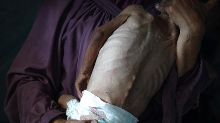 Gazzede son 24 saatte 5 Filistinli daha acliktan hayatini kaybetti