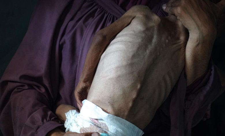 Gazzede son 24 saatte 5 Filistinli daha acliktan hayatini kaybetti
