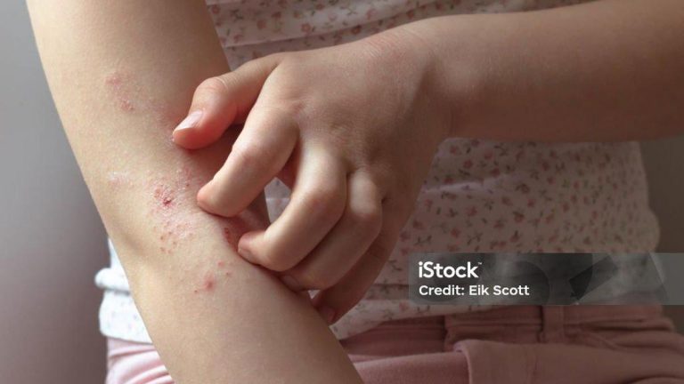 68d3fce3a362490a46fb8fcf